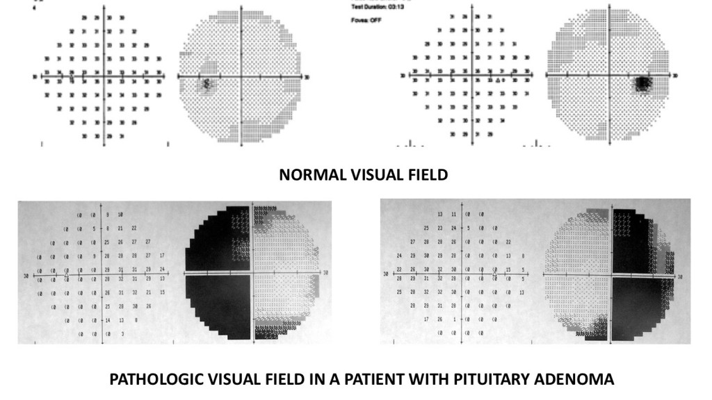 visual field